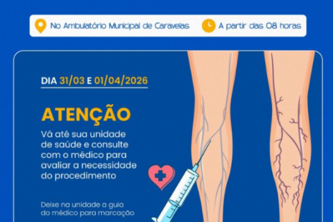 Caravelas promove mutirão para tratamento de varizes com técnica moderna